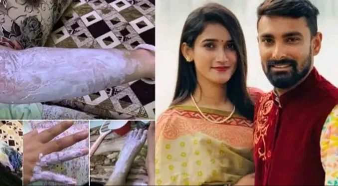 ‘या’ क्रिकेटपटूच्या घरात झाला गॅस सिलेंडरचा स्फोट