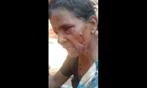 बिबटय़ाच्या हल्ल्यात महिलेसह वनअधिकारी जखमी