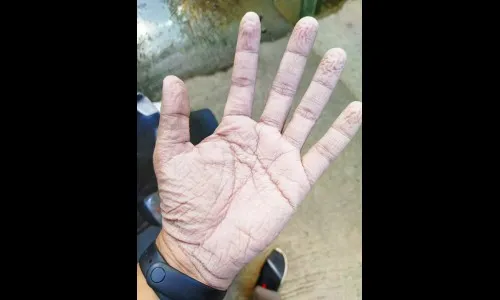 ..तरीही सार्वजनिक रुग्णालयांवर टीकाच