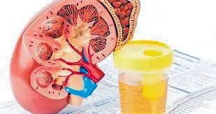 किडनीविकार ओळखण्यासाठी….