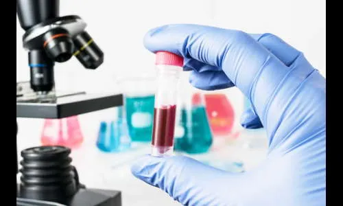 कोरोनातून वाचणार का ?…चाचणी देणार उत्तर