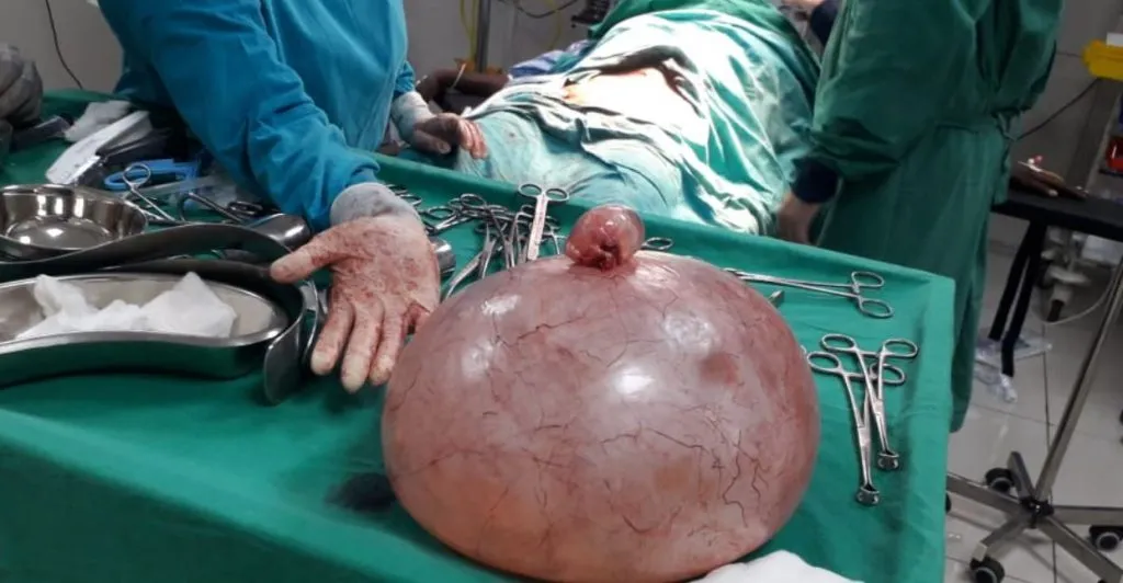 सिनर्जी हॉस्पिटलमध्ये अवघड शस्त्रक्रिया यशस्वी, दोन तास लॅप्रोटॉमी शस्त्रक्रिया