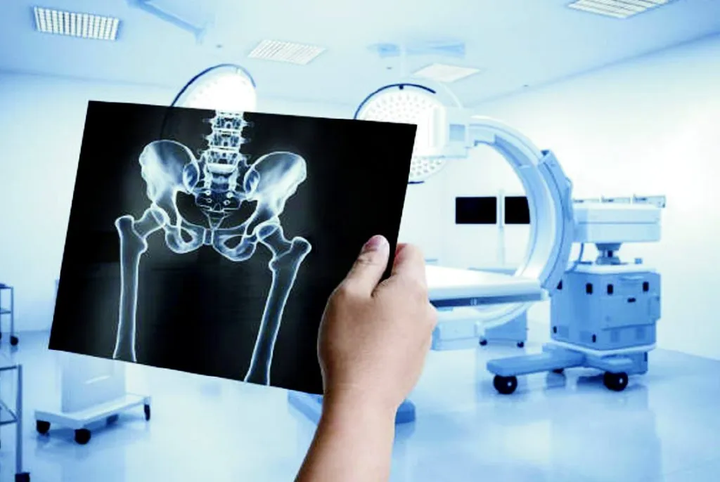 कोरोनामुक्तीनंतरचे संकट