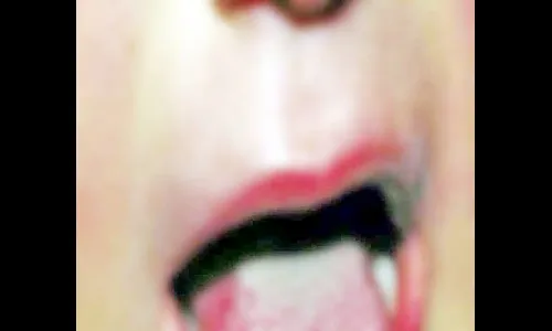 भारतात सापडला रोहाडनेटचा पहिला रुग्ण