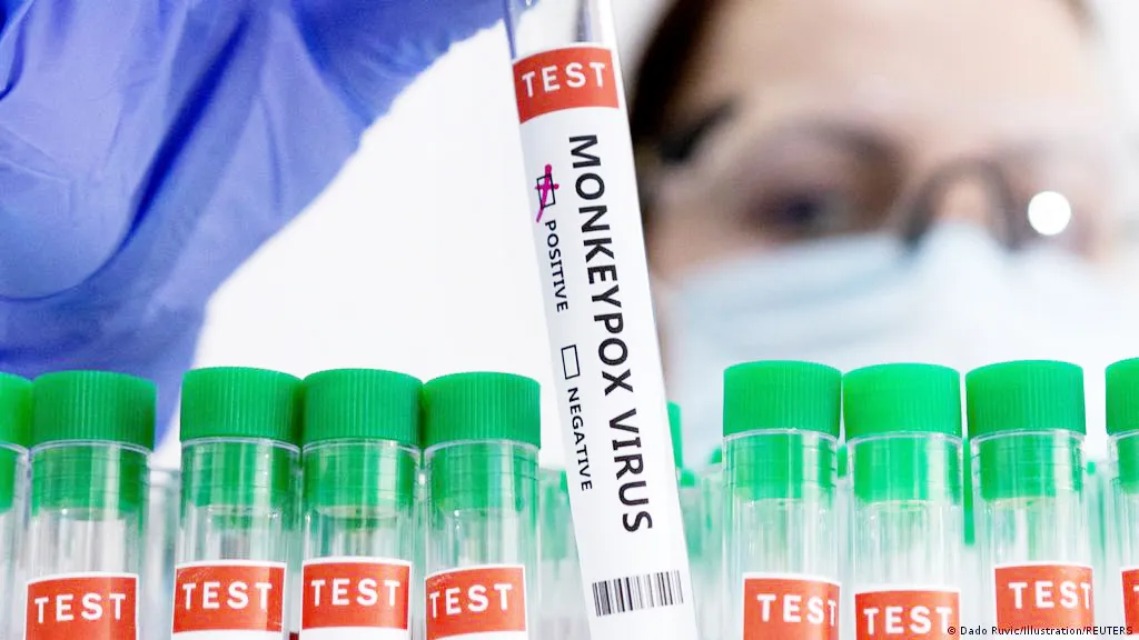 देशातील पहिल्या मंकीपॉक्स रुग्णाचा अहवाल निगेटिव्ह