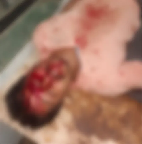 चक्क डोक्यात बियरची बाटली फोडून खुनाचा प्रयत्न