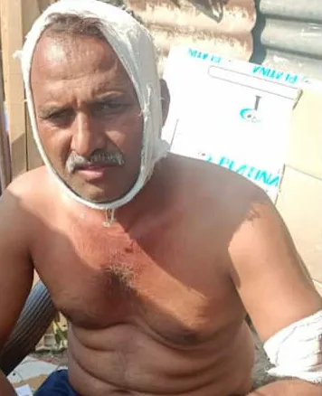 पुण्यात कोयता गँगचा हैदोस; ज्येष्ठ दाम्पत्यावर खुनी हल्ला