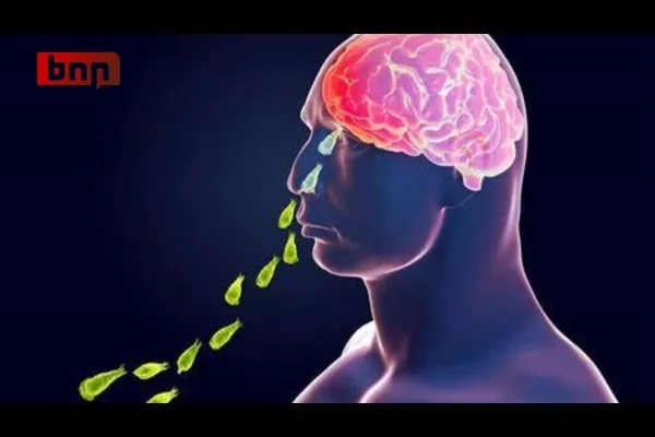 मानवी मेंदूच अमीबाने केला फस्त