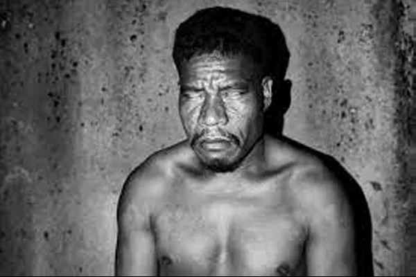 बेटावरील लोकांना दुर्लभ विकार