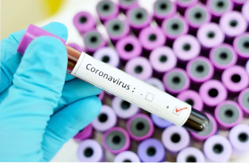 रविवारी जिल्ह्यात कोरोनाचे 14 नवे रुग्ण