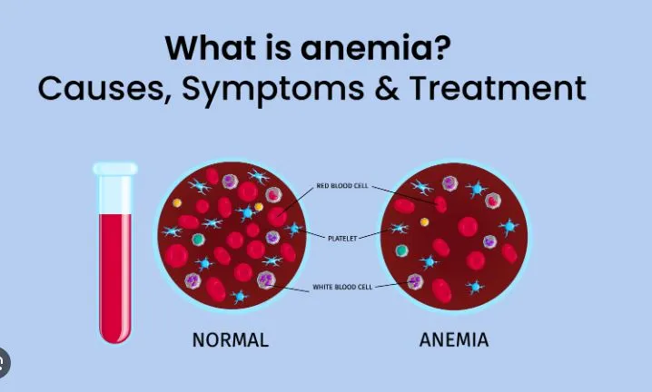 The cheapest medicine for anemia in India!