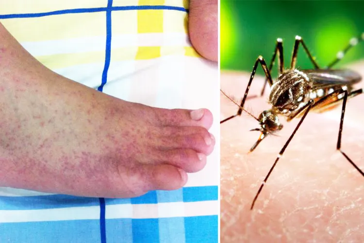 Awareness in rural areas about epidemic diseases