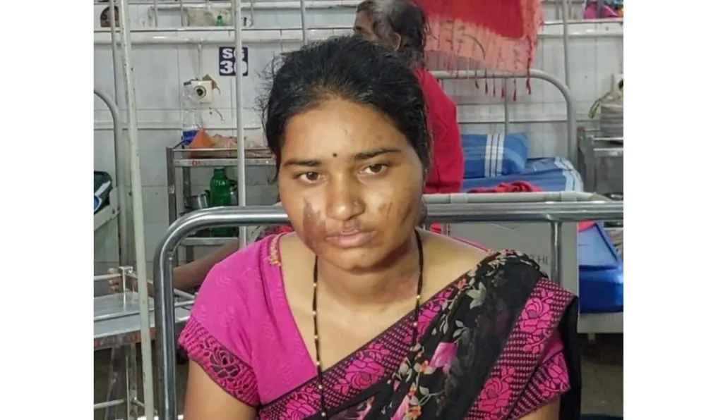 पोलीस पतीची पत्नीला शेडमध्ये कोंडून जबर मारहाण Policeman's wife was locked in a shed and severely beaten