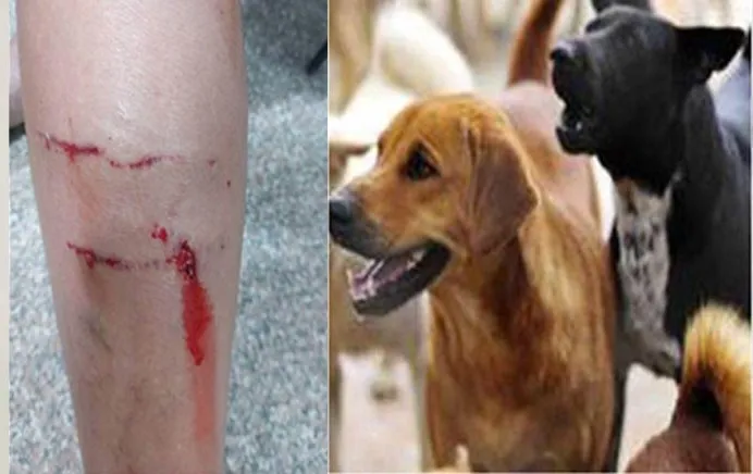 More than 30 lakh people are bitten by dogs every year