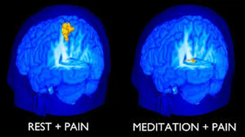 माइंडफुलनेस मेडिटेशनमुळे वेदनेपासून मिळतो दिलासा Mindfulness meditation provides relief from pain