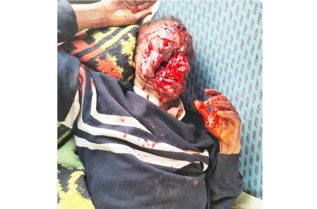 The forest department should spend on the injured in the bear attack