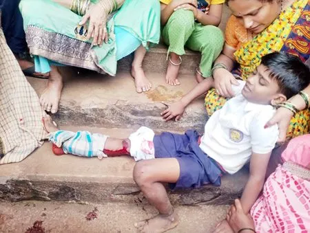 Monkey attacks child in Santibastwad