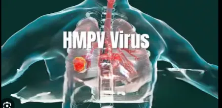 Health system on alert regarding HMPV infection