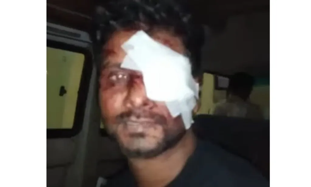 A prisoner was attacked in Kolwal Jail