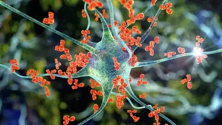 सीपीआरमध्ये ‘जीबीएस’चा आणखी एक रुग्ण दाखल Another GBS patient admitted to CPR