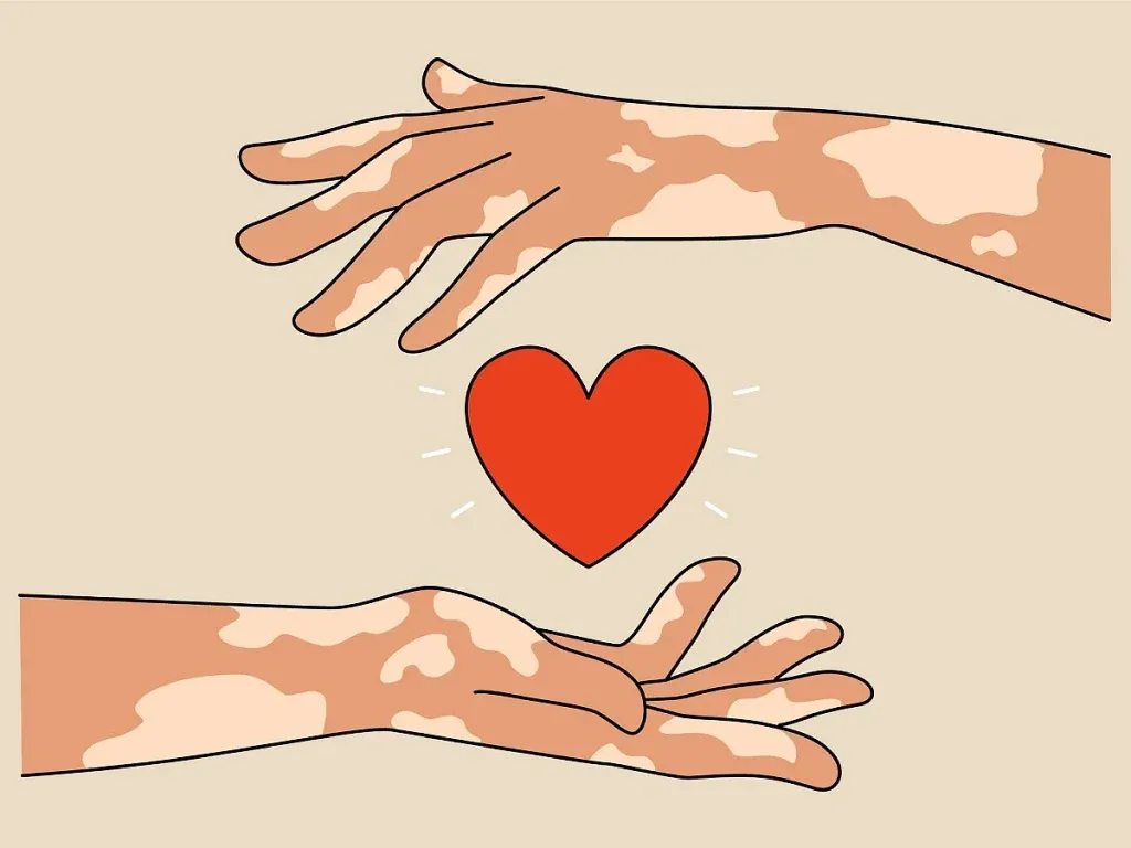 Leprosy spread possible at zero