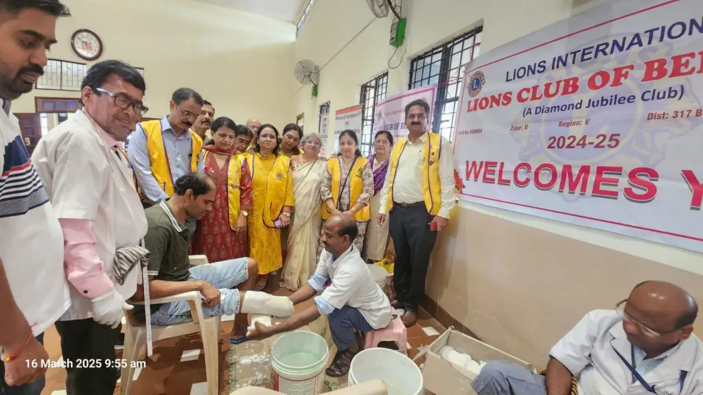 Lions Club organizes free artificial foot camp for the disabled