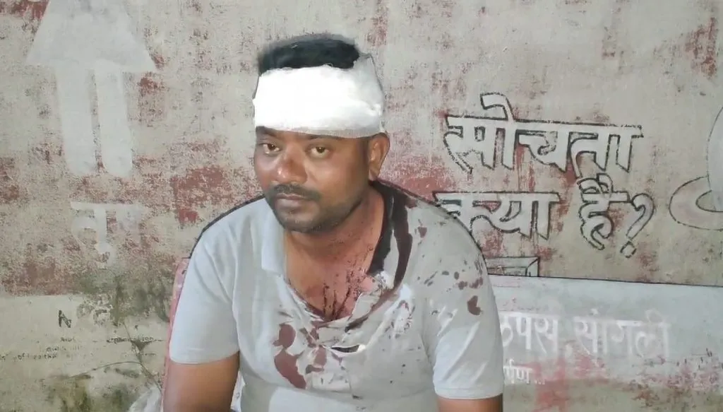 मनपा कर्मचाऱ्याच्या डोक्यात घातला दगड A stone was struck on the head of a municipal employee