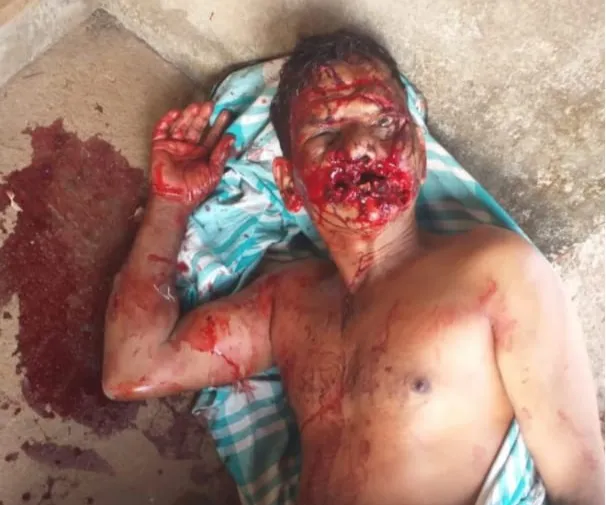 Farmer seriously injured in bear attack