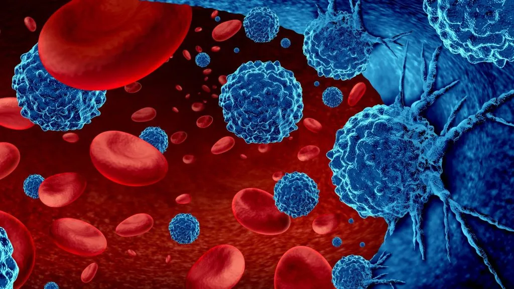 Gene therapy 73 percent effective in treating blood cancer
