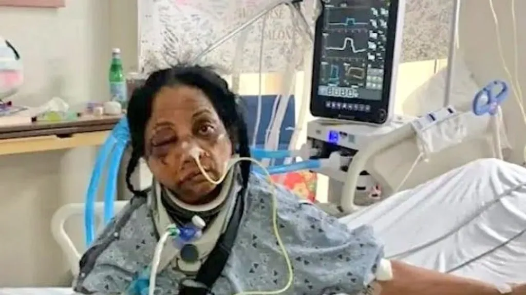 अमेरिकेत भारतीय नर्सला प्रचंड मारहाण Indian nurse brutally beaten in America