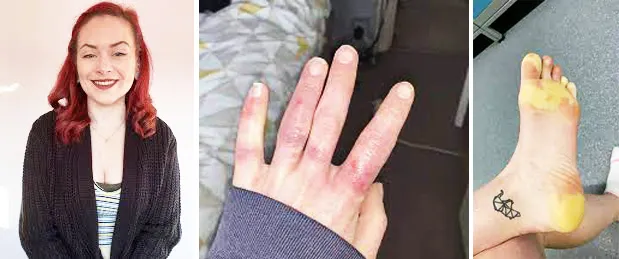 युवतीला अत्यंत अजब आजार A young woman has a very strange illness