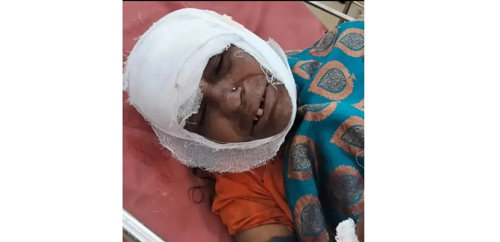 Elderly man attacked with a knife and robbed of jewelry