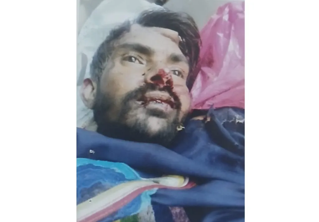 Unknown person killed in collision with unknown vehicle