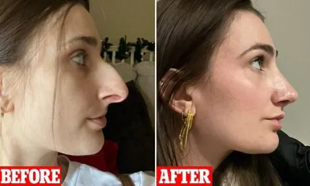 Surgery changed a woman's AYUSH