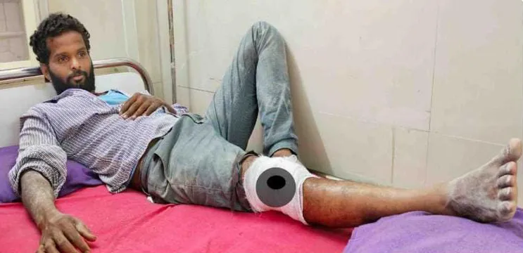 Worker seriously injured after being bitten by monkey