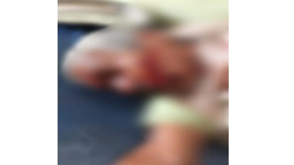 गवा रेड्याच्या हल्ल्यात चौकुळ येथील प्रौढ गंभीर जखमी