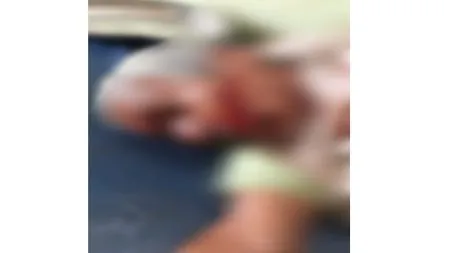 गवा रेड्याच्या हल्ल्यात चौकुळ येथील प्रौढ गंभीर जखमी