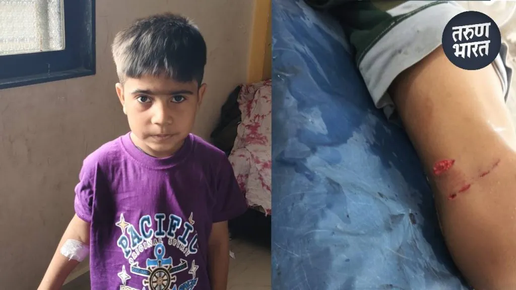 citizens and relatives area angry and expressed strong displeasure