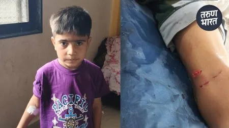 Sangli News: 6 वर्षांच्या मुलावर भटक्या कुत्र्यांचा हल्ला, सांगतीलीत धक्कादायक घटना citizens and relatives area angry and expressed strong displeasure