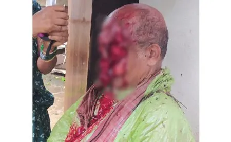 Bear attack near Kankumbi check post, farmer seriously injured