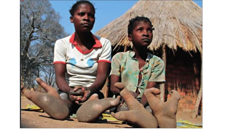 Only two toes on the feet