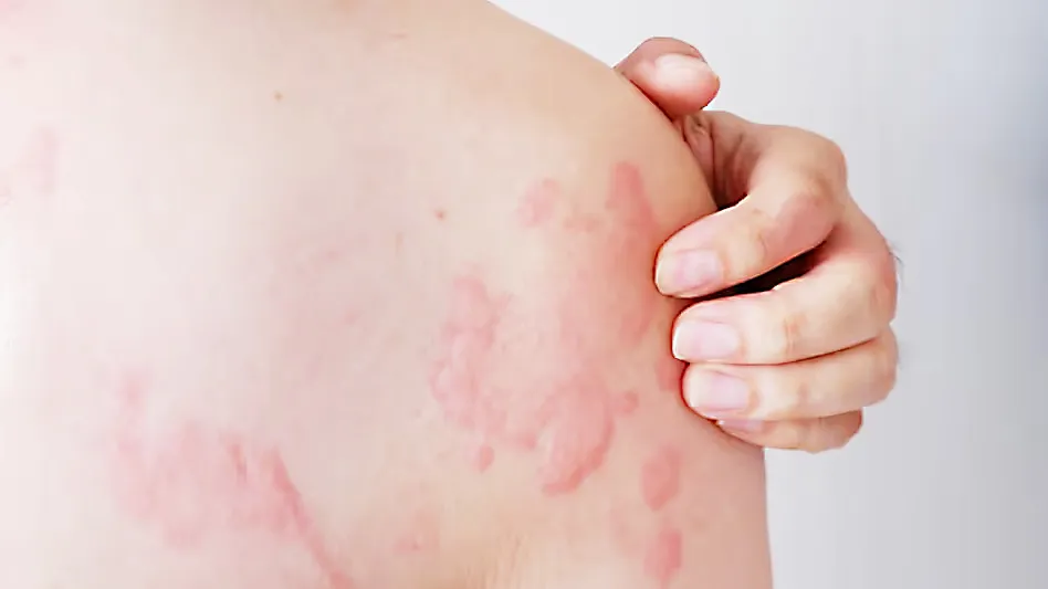 पाण्याचाच दाह… The pressure of water...