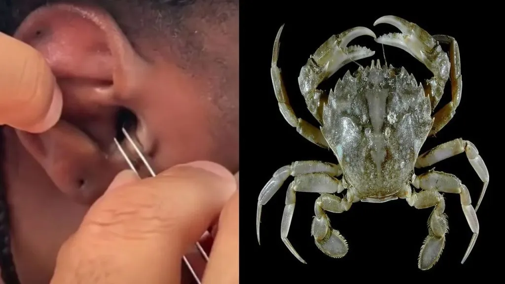 'Crab' in the ear