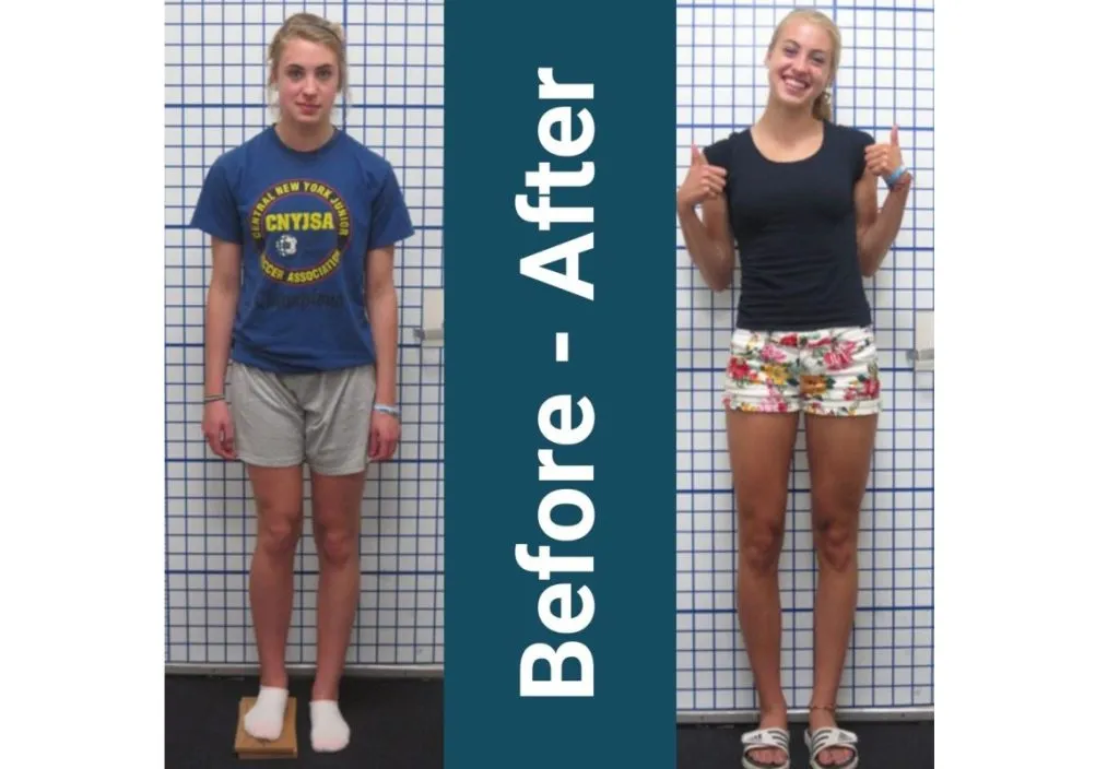 The type of height reduction for love