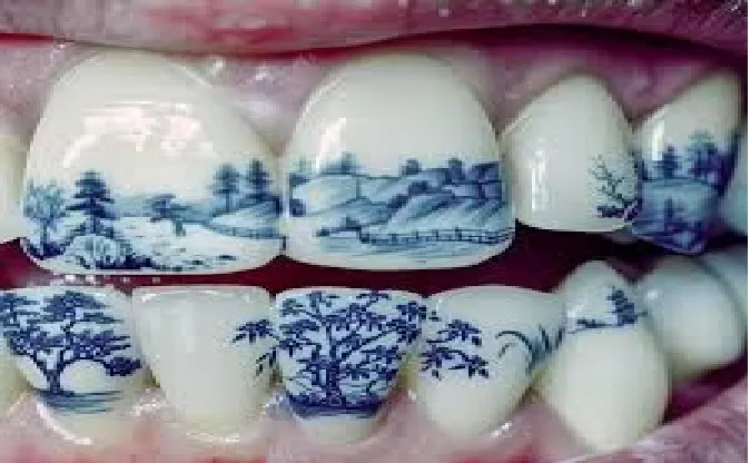 The 'trend' of 'tattooing' teeth