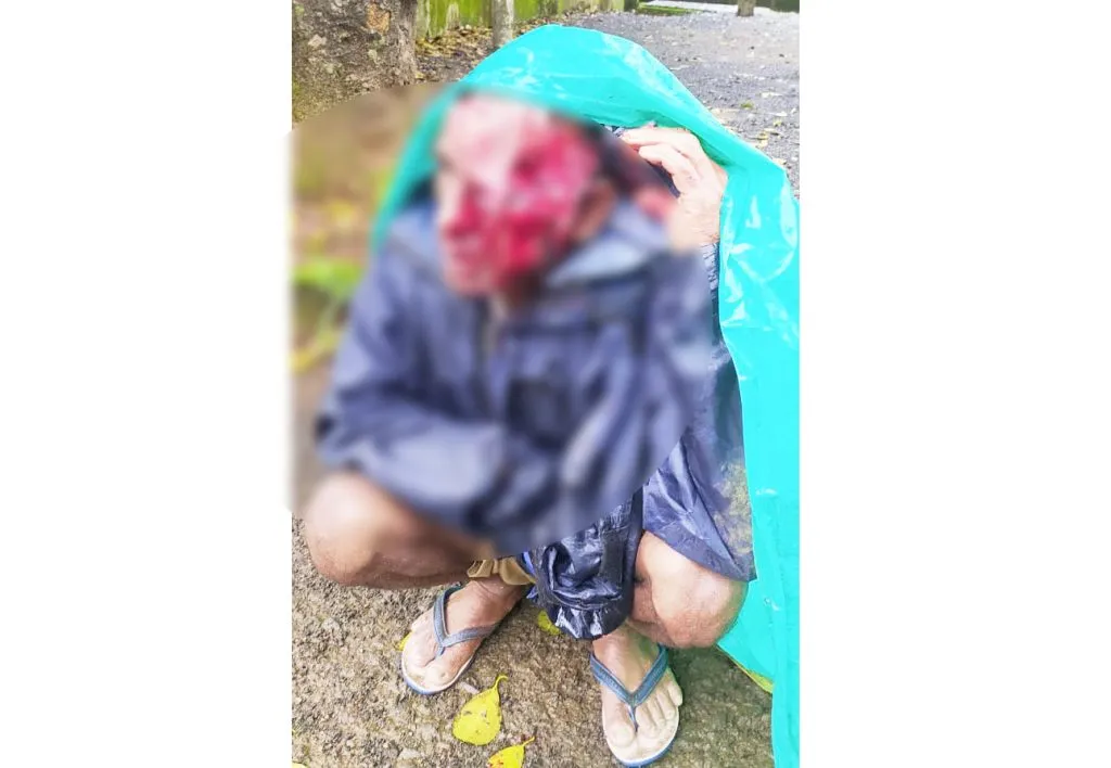 अस्वलाच्या हल्ल्यात शेतकरी गंभीर जखमी Farmer seriously injured in bear attack