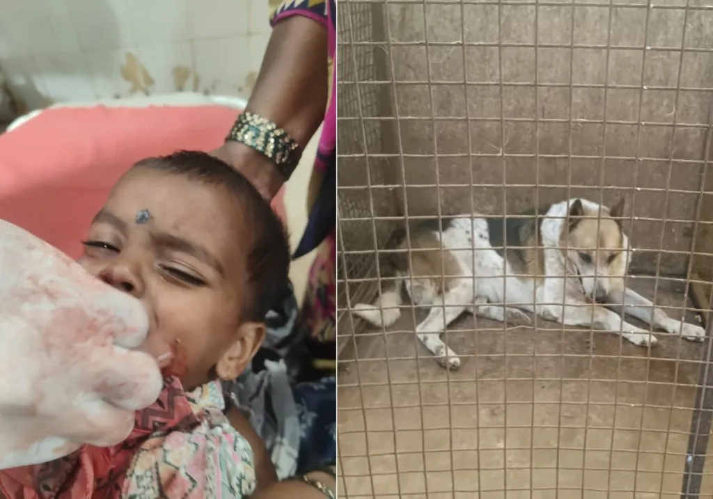भटक्या कुत्र्याने तोडले बालिकेच्या चेहऱ्याचे लचके Two-year-old girl seriously injured after being attacked by stray dog