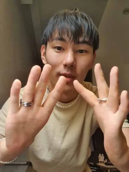 अंगठ्यांशिवाय झाला जन्म Born without thumbs