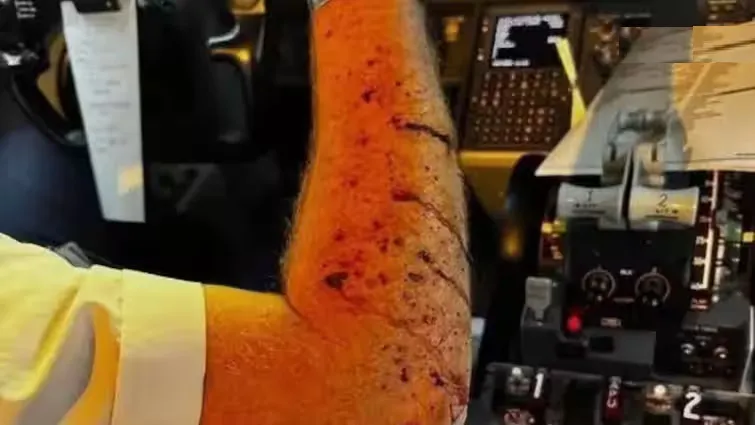 विमानाची दर्शनी काच हवेतच फुटली The plane's windshield shattered in mid-air.