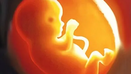 Five arrested in illegal sex testing, female foeticide case